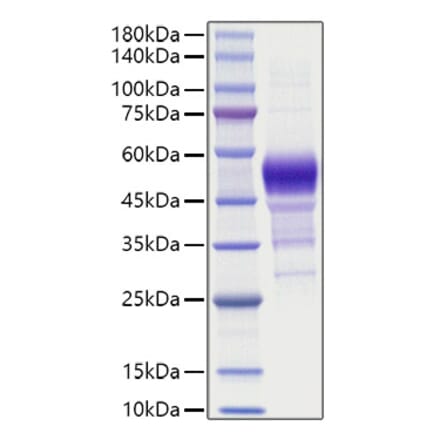 SDS-PAGE - Recombinant Human BTC Protein (C-terminal Human Fc Tag) (A330167) - Antibodies.com