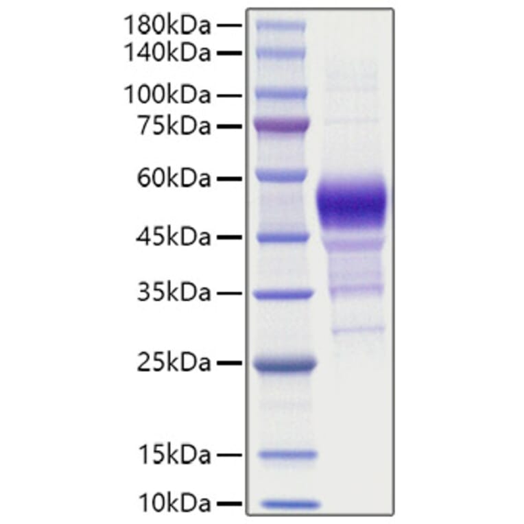 SDS-PAGE - Recombinant Human BTC Protein (C-terminal Human Fc Tag) (A330167) - Antibodies.com