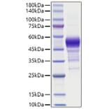 SDS-PAGE - Recombinant Human BTC Protein (C-terminal Human Fc Tag) (A330167) - Antibodies.com