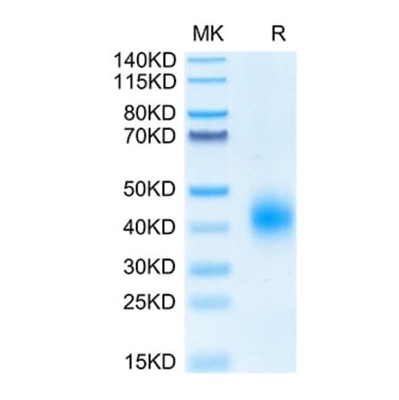 Tris-Bis PAGE - Recombinant Human BTLA Protein (Biotin) (C-terminal His and Avi Tag) (A330168) - Antibodies.com