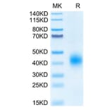 Tris-Bis PAGE - Recombinant Human BTLA Protein (Biotin) (C-terminal His and Avi Tag) (A330168) - Antibodies.com