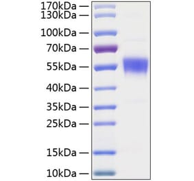 SDS-PAGE - Recombinant Human BTLA Protein (C-terminal Human Fc and His Tag) (A330169) - Antibodies.com