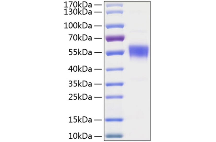 SDS-PAGE - Recombinant Human BTLA Protein (C-terminal Human Fc and His Tag) (A330169) - Antibodies.com