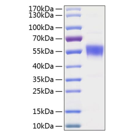 SDS-PAGE - Recombinant Human BTLA Protein (C-terminal Human Fc and His Tag) (A330169) - Antibodies.com