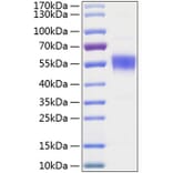 SDS-PAGE - Recombinant Human BTLA Protein (C-terminal Human Fc and His Tag) (A330169) - Antibodies.com