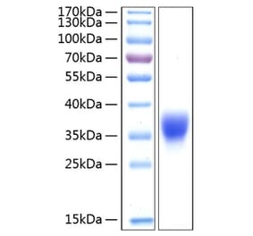 SDS-PAGE - Recombinant Human BTN1A1 Protein (C-terminal His Tag) (A330170) - Antibodies.com
