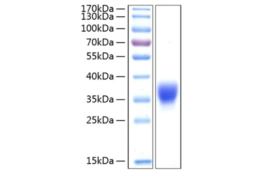SDS-PAGE - Recombinant Human BTN1A1 Protein (C-terminal His Tag) (A330170) - Antibodies.com