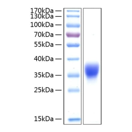 SDS-PAGE - Recombinant Human BTN1A1 Protein (C-terminal His Tag) (A330170) - Antibodies.com