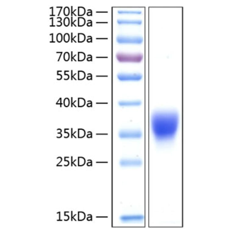 SDS-PAGE - Recombinant Human BTN1A1 Protein (C-terminal His Tag) (A330170) - Antibodies.com