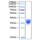 SDS-PAGE - Recombinant Human BTN1A1 Protein (C-terminal His Tag) (A330170) - Antibodies.com