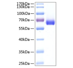 SDS-PAGE - Recombinant Human BTN1A1 Protein (C-terminal Human Fc and His Tag) (A330171) - Antibodies.com