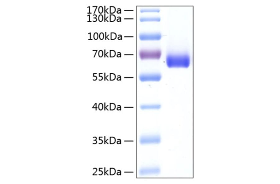 SDS-PAGE - Recombinant Human BTN1A1 Protein (C-terminal Human Fc and His Tag) (A330171) - Antibodies.com