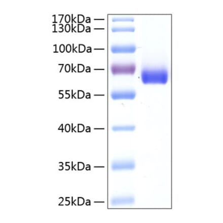 SDS-PAGE - Recombinant Human BTN1A1 Protein (C-terminal Human Fc and His Tag) (A330171) - Antibodies.com