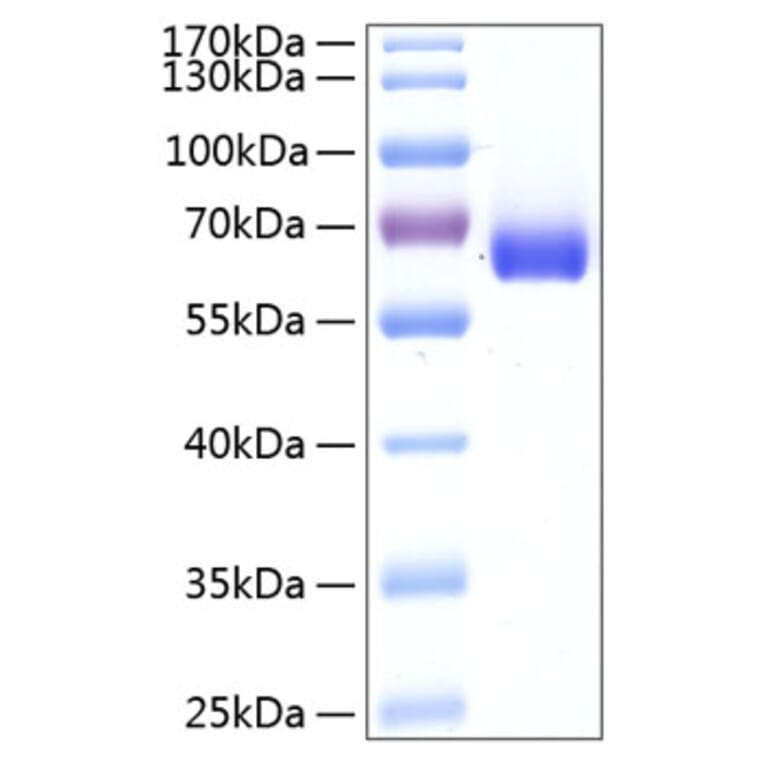 SDS-PAGE - Recombinant Human BTN1A1 Protein (C-terminal Human Fc and His Tag) (A330171) - Antibodies.com