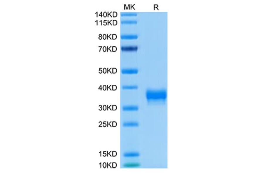 Tris-Bis PAGE - Recombinant Human BTN1A1 Protein (Biotin) (C-terminal His and Avi Tag) (A330172) - Antibodies.com