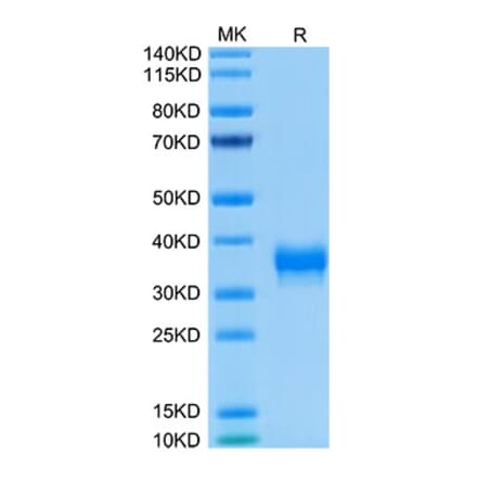 Tris-Bis PAGE - Recombinant Human BTN1A1 Protein (Biotin) (C-terminal His and Avi Tag) (A330172) - Antibodies.com
