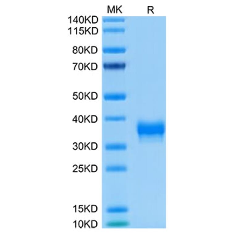 Tris-Bis PAGE - Recombinant Human BTN1A1 Protein (Biotin) (C-terminal His and Avi Tag) (A330172) - Antibodies.com