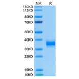 Tris-Bis PAGE - Recombinant Human BTN1A1 Protein (Biotin) (C-terminal His and Avi Tag) (A330172) - Antibodies.com