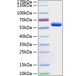 SDS-PAGE - Recombinant Human BTN3A1 Protein (C-terminal Human Fc and His Tag) (A330173) - Antibodies.com