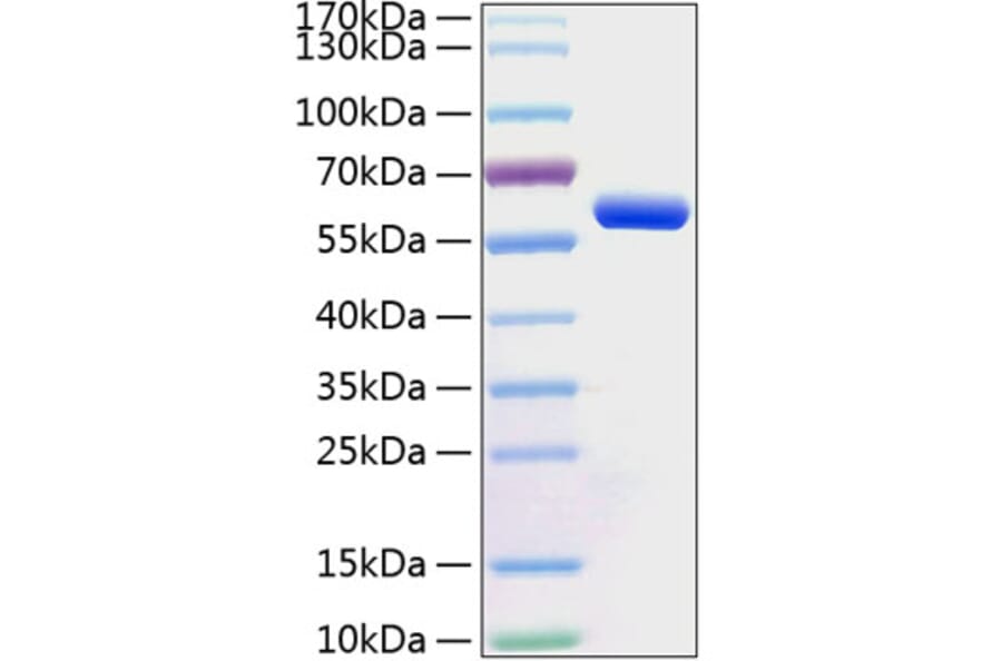 SDS-PAGE - Recombinant Human BTN3A1 Protein (C-terminal Human Fc and His Tag) (A330173) - Antibodies.com