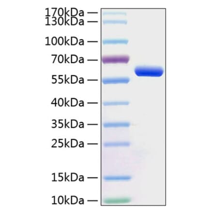 SDS-PAGE - Recombinant Human BTN3A1 Protein (C-terminal Human Fc and His Tag) (A330173) - Antibodies.com