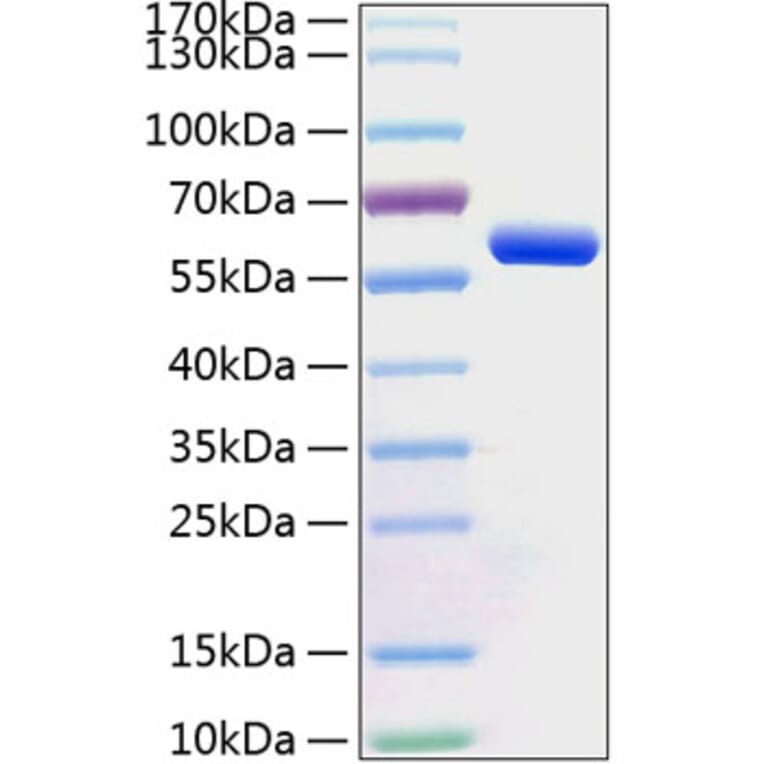 SDS-PAGE - Recombinant Human BTN3A1 Protein (C-terminal Human Fc and His Tag) (A330173) - Antibodies.com