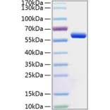 SDS-PAGE - Recombinant Human BTN3A1 Protein (C-terminal Human Fc and His Tag) (A330173) - Antibodies.com
