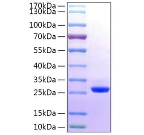 SDS-PAGE - Recombinant Human BTN3A2 Protein (C-terminal His Tag) (A330174) - Antibodies.com
