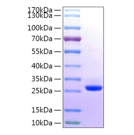 SDS-PAGE - Recombinant Human BTN3A2 Protein (C-terminal His Tag) (A330174) - Antibodies.com