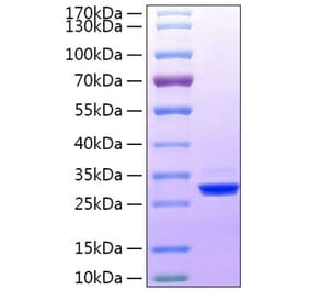 SDS-PAGE - Recombinant Human BTN3A3 Protein (C-terminal His Tag) (A330175) - Antibodies.com