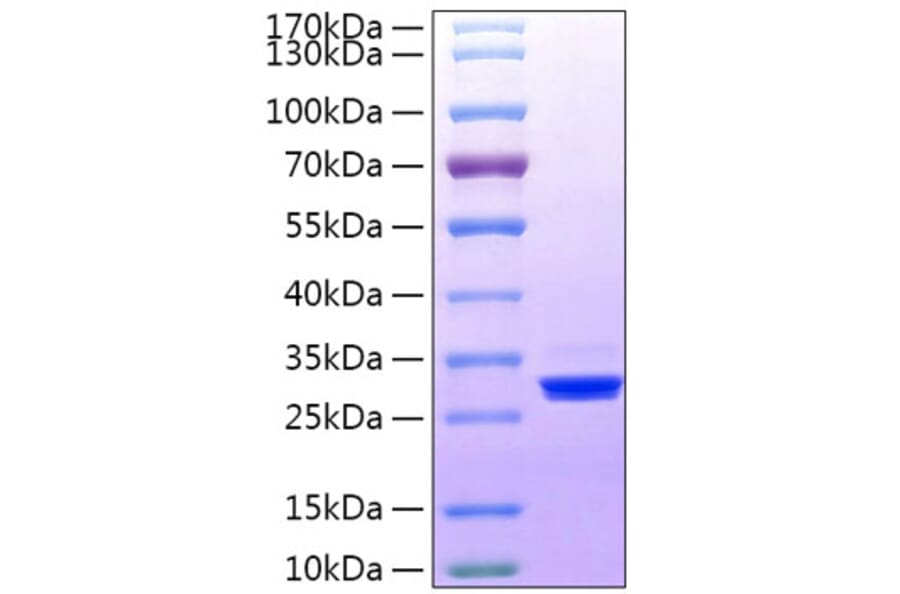 SDS-PAGE - Recombinant Human BTN3A3 Protein (C-terminal His Tag) (A330175) - Antibodies.com
