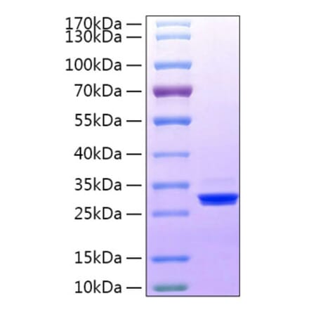 SDS-PAGE - Recombinant Human BTN3A3 Protein (C-terminal His Tag) (A330175) - Antibodies.com