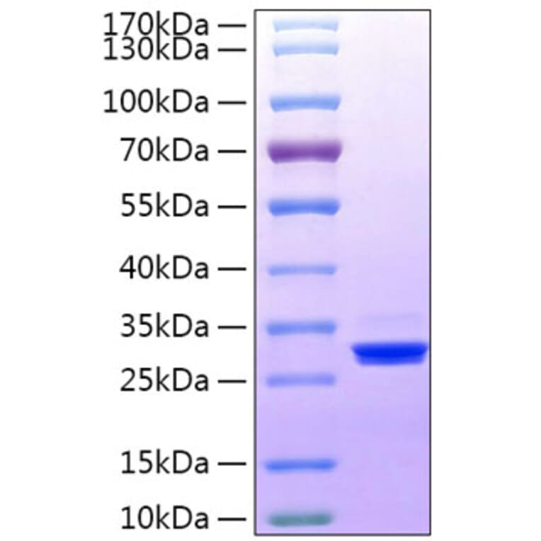 SDS-PAGE - Recombinant Human BTN3A3 Protein (C-terminal His Tag) (A330175) - Antibodies.com