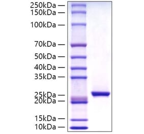 SDS-PAGE - Recombinant Human C Reactive Protein Protein (C-terminal His Tag) (A330176) - Antibodies.com