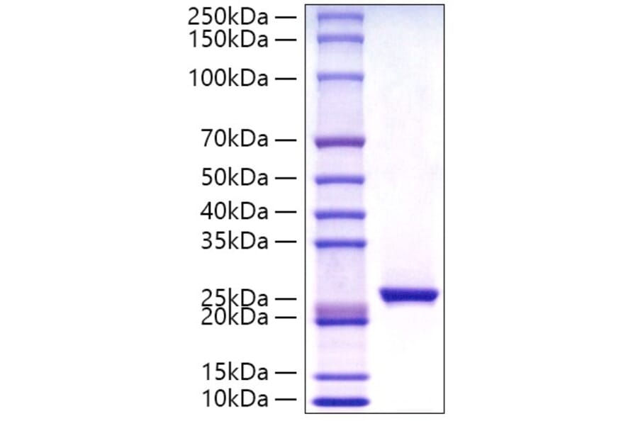 SDS-PAGE - Recombinant Human C Reactive Protein Protein (C-terminal His Tag) (A330176) - Antibodies.com