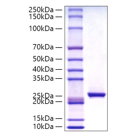 SDS-PAGE - Recombinant Human C Reactive Protein Protein (C-terminal His Tag) (A330176) - Antibodies.com