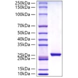SDS-PAGE - Recombinant Human C Reactive Protein Protein (C-terminal His Tag) (A330176) - Antibodies.com