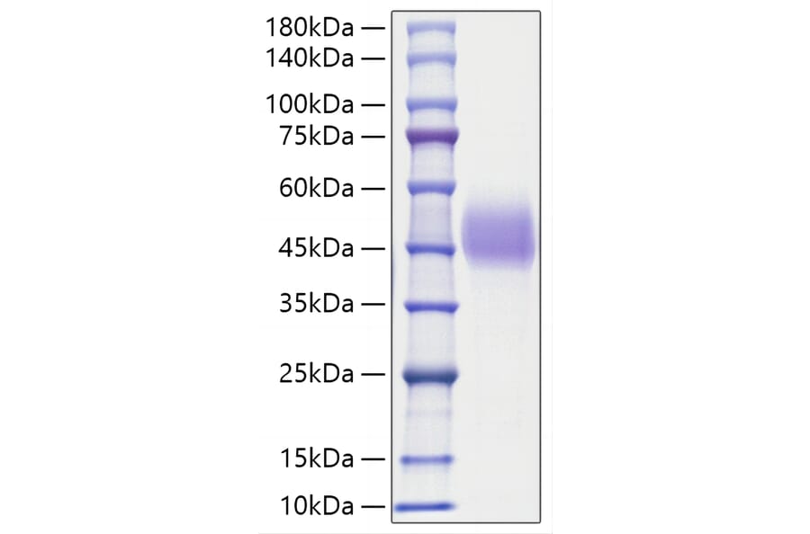 SDS-PAGE - Recombinant Human C1QC Protein (N-terminal His and Human Fc Tag) (A330177) - Antibodies.com