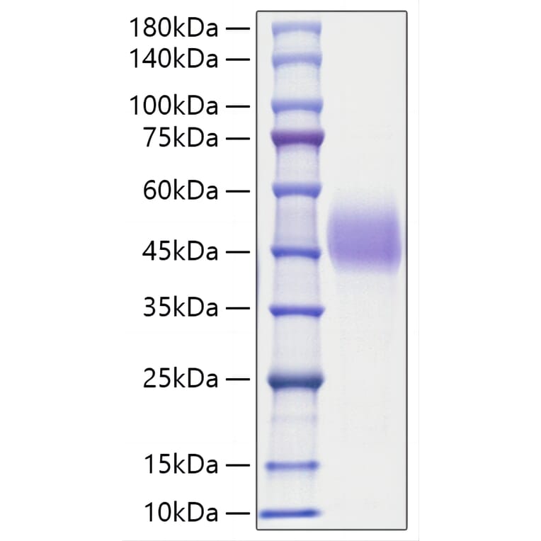 SDS-PAGE - Recombinant Human C1QC Protein (N-terminal His and Human Fc Tag) (A330177) - Antibodies.com