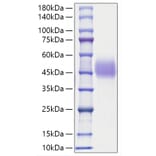 SDS-PAGE - Recombinant Human C1QC Protein (N-terminal His and Human Fc Tag) (A330177) - Antibodies.com