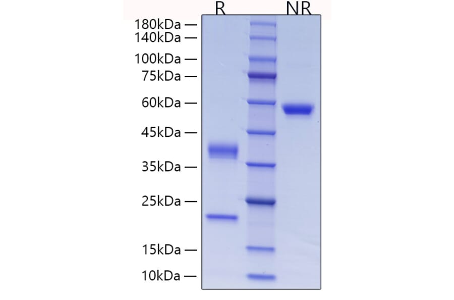 SDS-PAGE - Recombinant Human C1R Protein (C-terminal His Tag) (A330178) - Antibodies.com
