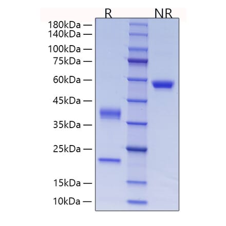 SDS-PAGE - Recombinant Human C1R Protein (C-terminal His Tag) (A330178) - Antibodies.com