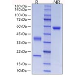 SDS-PAGE - Recombinant Human C1R Protein (C-terminal His Tag) (A330178) - Antibodies.com