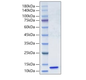 SDS-PAGE - Recombinant Human C5 Protein (A330179) - Antibodies.com