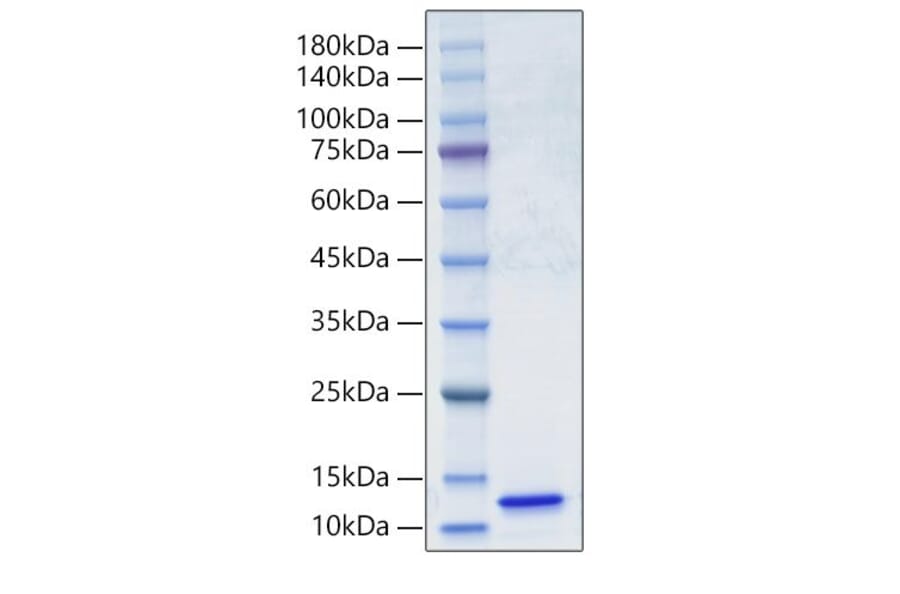 SDS-PAGE - Recombinant Human C5 Protein (A330179) - Antibodies.com