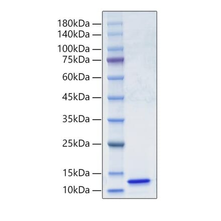 SDS-PAGE - Recombinant Human C5 Protein (A330179) - Antibodies.com