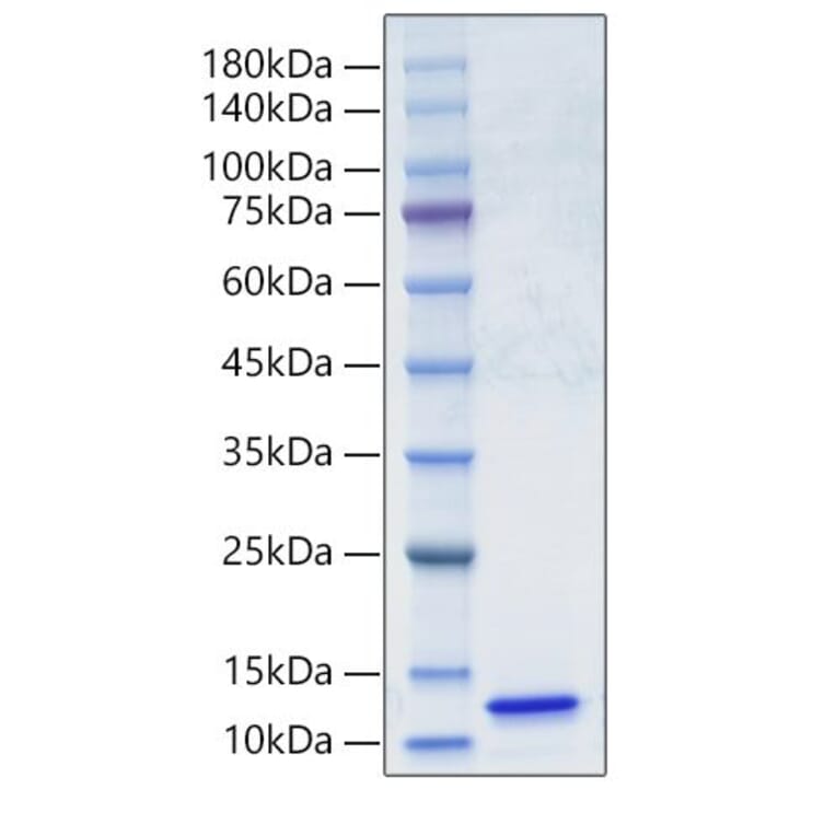 SDS-PAGE - Recombinant Human C5 Protein (A330179) - Antibodies.com