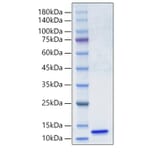 SDS-PAGE - Recombinant Human C5 Protein (A330179) - Antibodies.com