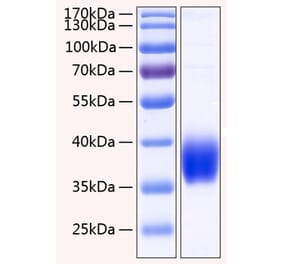 SDS-PAGE - Recombinant Human CA12 Protein (C-terminal His Tag) (A330180) - Antibodies.com
