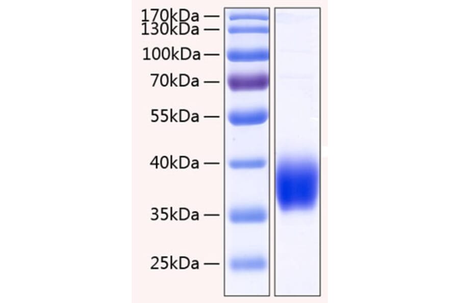 SDS-PAGE - Recombinant Human CA12 Protein (C-terminal His Tag) (A330180) - Antibodies.com